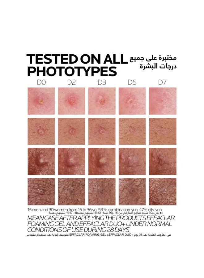 عام لا روش بوزيه إيفاكلار ديو+إم كريم علاج البثور 40 مل - للبشرة الدهنية والمُعرضة للبثور - Image 4